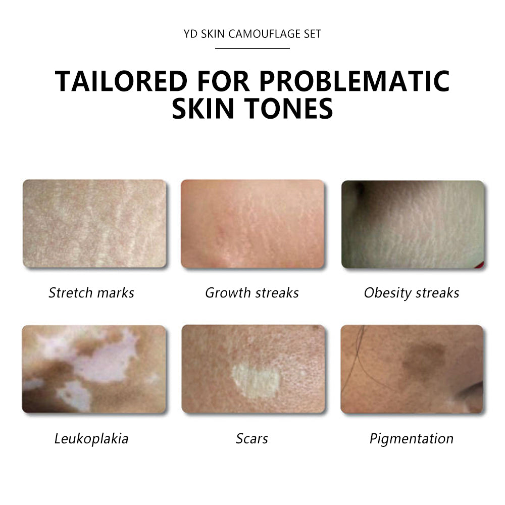YD SKIN CAMOUFLOUGE SET FOR STRECH MARK / SCAR / VITILIGO - CharmingTattooSupply
