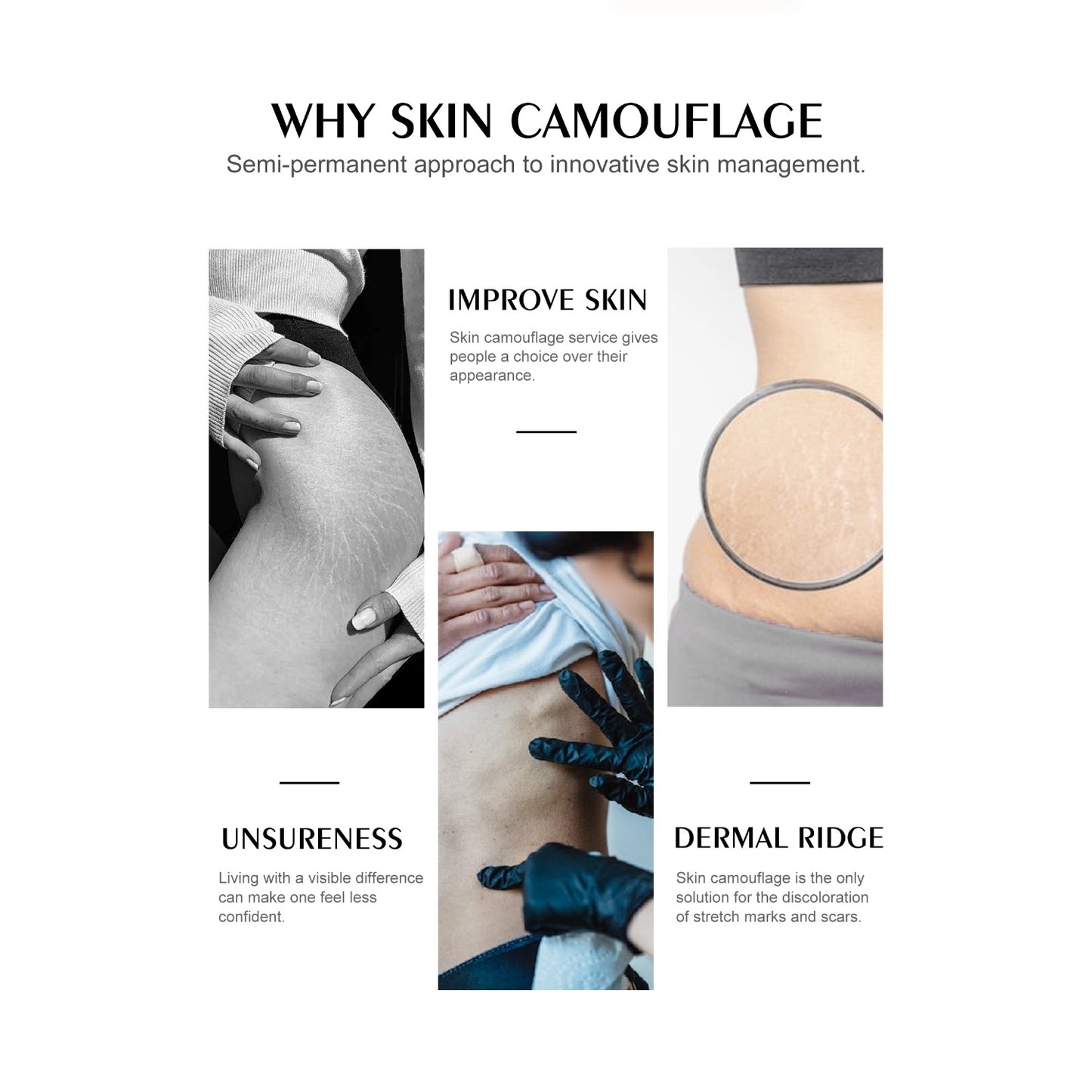 SK-10 – YDPMU Skin Camouflage Pigment | Deep Brown Skin Tone Scar Camouflage Ink for Rich Deep Skin