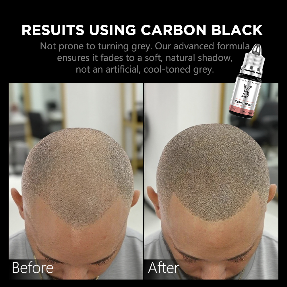 CARBON BLACK