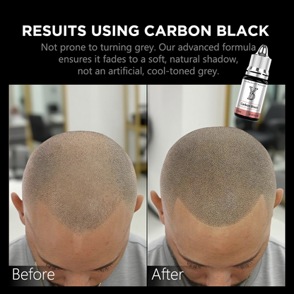 CARBON BLACK